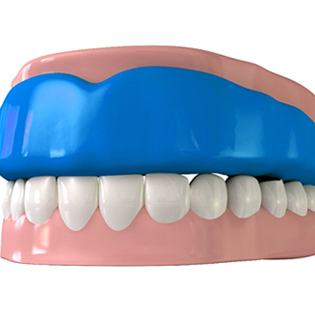 animation of mouthguard on top teeth