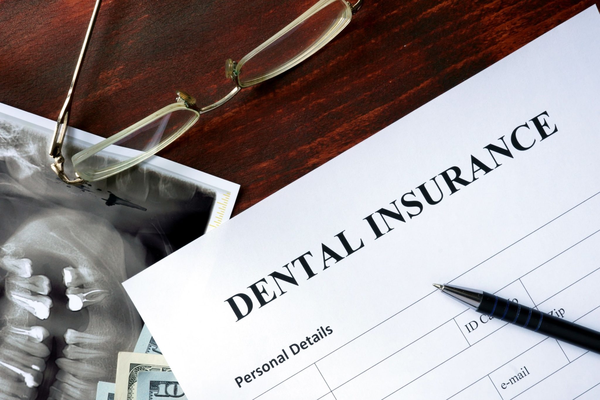 Does Dental Insurance Cover Orthodontic Treatments L Dr Cartwright